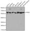 Prolyl 4-Hydroxylase Subunit Beta antibody, A0692, ABclonal Technology, Western Blot image 
