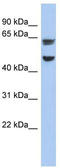 Zona Pellucida Glycoprotein 1 antibody, TA335103, Origene, Western Blot image 