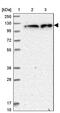 Zinc Finger CCCH-Type Containing 7A antibody, PA5-59306, Invitrogen Antibodies, Western Blot image 