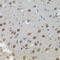 n-myc antibody, 13-185, ProSci, Immunohistochemistry frozen image 