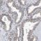 Mannosyl-oligosaccharide glucosidase antibody, NBP1-81839, Novus Biologicals, Immunohistochemistry paraffin image 