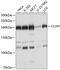 Protein KIAA0664 antibody, GTX66049, GeneTex, Western Blot image 