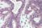X-Box Binding Protein 1 antibody, orb19868, Biorbyt, Immunohistochemistry paraffin image 