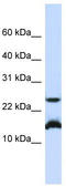 Basic Leucine Zipper ATF-Like Transcription Factor antibody, TA343606, Origene, Western Blot image 