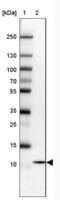 Cytochrome C Oxidase Assembly Factor 5 antibody, NBP2-31690, Novus Biologicals, Western Blot image 