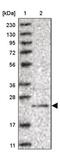 Coiled-Coil Domain Containing 115 antibody, PA5-56987, Invitrogen Antibodies, Western Blot image 