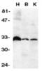 TNF Receptor Superfamily Member 6b antibody, AHP1603, Bio-Rad (formerly AbD Serotec) , Immunohistochemistry paraffin image 