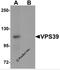 Vam6/Vps39-like protein antibody, 6183, ProSci, Western Blot image 