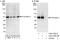 Arrestin Beta 2 antibody, A303-786A, Bethyl Labs, Immunoprecipitation image 