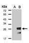 GAIP antibody, GTX106302, GeneTex, Western Blot image 