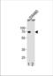 ETS translocation variant 5 antibody, TA324368, Origene, Western Blot image 