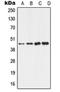 Aldehyde Dehydrogenase 3 Family Member B2 antibody, orb213550, Biorbyt, Western Blot image 