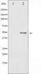 BLNK antibody, TA325275, Origene, Western Blot image 