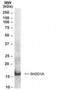 SH2 Domain Containing 1A antibody, NB100-1895, Novus Biologicals, Western Blot image 