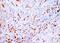 Tubulin Beta 1 Class VI antibody, MA1112, Boster Biological Technology, Immunohistochemistry frozen image 