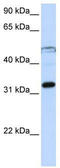 Eukaryotic translation initiation factor 3 subunit G antibody, TA345852, Origene, Western Blot image 