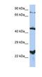 Magnesium Transporter MRS2 antibody, NBP1-59614, Novus Biologicals, Western Blot image 