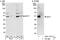 Histone-lysine N-methyltransferase SETD7 antibody, A301-747A, Bethyl Labs, Immunoprecipitation image 