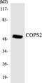 COP9 Signalosome Subunit 2 antibody, EKC1759, Boster Biological Technology, Western Blot image 