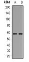 Dopachrome Tautomerase antibody, orb382701, Biorbyt, Western Blot image 