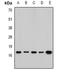 Ribosomal Protein Lateral Stalk Subunit P1 antibody, orb382015, Biorbyt, Western Blot image 