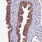 Dynein Cytoplasmic 2 Heavy Chain 1 antibody, NBP2-38437, Novus Biologicals, Immunohistochemistry paraffin image 