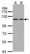 Glutamyl Aminopeptidase antibody, orb89506, Biorbyt, Western Blot image 