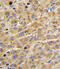 ADAMTS13 antibody, 62-911, ProSci, Immunohistochemistry paraffin image 