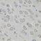 Myosin-X antibody, FNab05498, FineTest, Immunohistochemistry paraffin image 