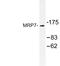 ATP Binding Cassette Subfamily C Member 10 antibody, LS-C177383, Lifespan Biosciences, Western Blot image 