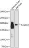 SEC31 Homolog A, COPII Coat Complex Component antibody, 23-843, ProSci, Western Blot image 