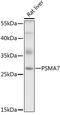 Proteasome subunit alpha type-7 antibody, 19-258, ProSci, Western Blot image 