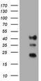 Transmembrane Protein 173 antibody, TA505020BM, Origene, Western Blot image 