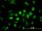 Acetyl-CoA Acyltransferase 2 antibody, H00010449-M01, Novus Biologicals, Immunocytochemistry image 