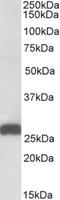 Electron transfer flavoprotein subunit beta antibody, NBP1-49844, Novus Biologicals, Western Blot image 