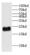 Coiled-Coil-Helix-Coiled-Coil-Helix Domain Containing 4 antibody, FNab01637, FineTest, Western Blot image 