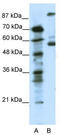 5-Hydroxytryptamine Receptor 7 antibody, TA329999, Origene, Western Blot image 