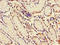 Mucin 1, Cell Surface Associated antibody, A52829-100, Epigentek, Immunohistochemistry paraffin image 