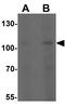 Klotho antibody, GTX17093, GeneTex, Western Blot image 