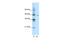 DEAD-Box Helicase 25 antibody, 28-491, ProSci, Enzyme Linked Immunosorbent Assay image 