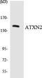 Sca2 antibody, LS-C200163, Lifespan Biosciences, Western Blot image 