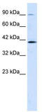 Zinc Finger Protein 830 antibody, TA341436, Origene, Western Blot image 