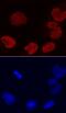 Protein DEK antibody, MAB70201, R&D Systems, Immunocytochemistry image 