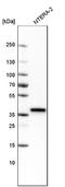 Quiescin Sulfhydryl Oxidase 1 antibody, NBP2-59057, Novus Biologicals, Western Blot image 