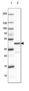 Glutamate-Ammonia Ligase antibody, NBP2-46643, Novus Biologicals, Western Blot image 