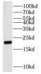 Nudix Hydrolase 16 antibody, FNab05901, FineTest, Western Blot image 