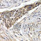 Fizzy And Cell Division Cycle 20 Related 1 antibody, A5550, ABclonal Technology, Immunohistochemistry paraffin image 