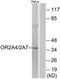 Olfactory Receptor Family 2 Subfamily A Member 7 antibody, TA316453, Origene, Western Blot image 