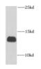 Cytochrome C Oxidase Subunit 6B1 antibody, FNab01904, FineTest, Western Blot image 