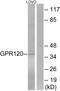 Free fatty acid receptor 4 antibody, A19859, Boster Biological Technology, Western Blot image 